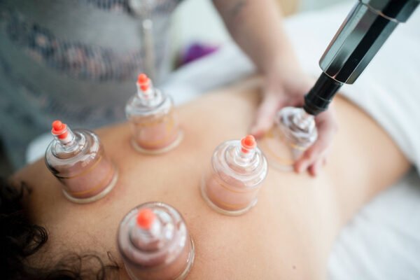 Massage Cupping Therapy: A Hidden Gem in Fort Collins Massage