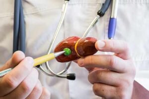 Gall Bladder Surgery