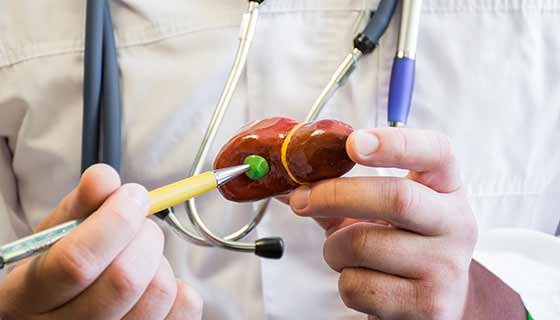 Gall Bladder Surgery