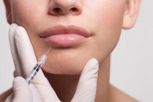 lip fillers madison